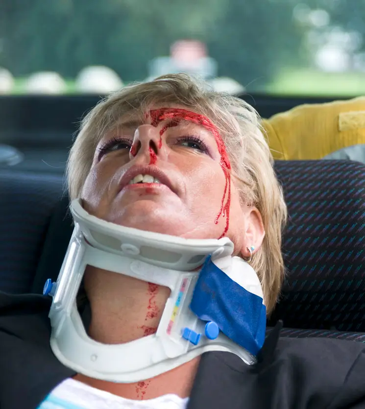 Injured woman in neck brace with facial bleeding lying in car after serious crash